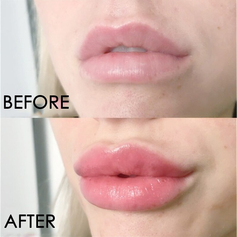 LABIAL VOLUMINIZADOR 💄💋